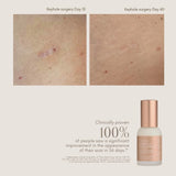 Complex Scar Serum