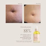 Pure Mama Belly & Body Oil